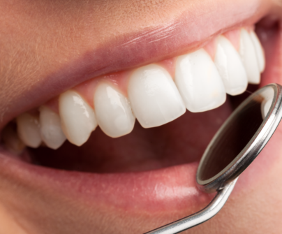 dental cleaning in vancouver tips and tricks by broadway smiles dental clinic in vancouver