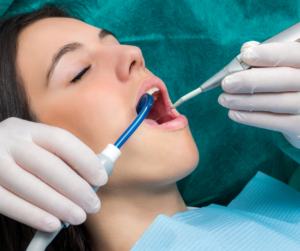 Dental cleaning in Vancouver at broadway smiles dental clinic. 
