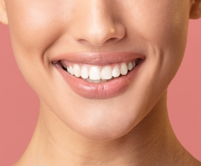teeth whitening in vancouver by dentist in kitsilano broadway smiles.