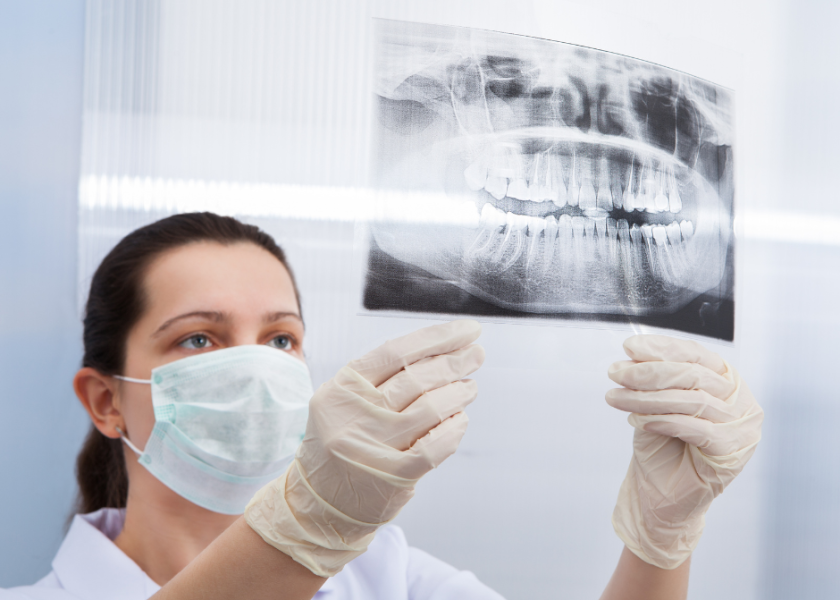 Why Xrays are important for teeth whitening in Vancouver. Broadway Smiles Dentist in Vancouver is pictured holding xrays.