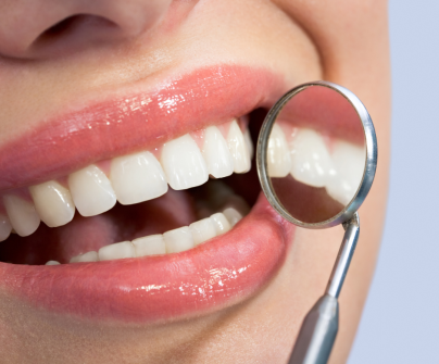 Benefits of Getting a Dental Polish